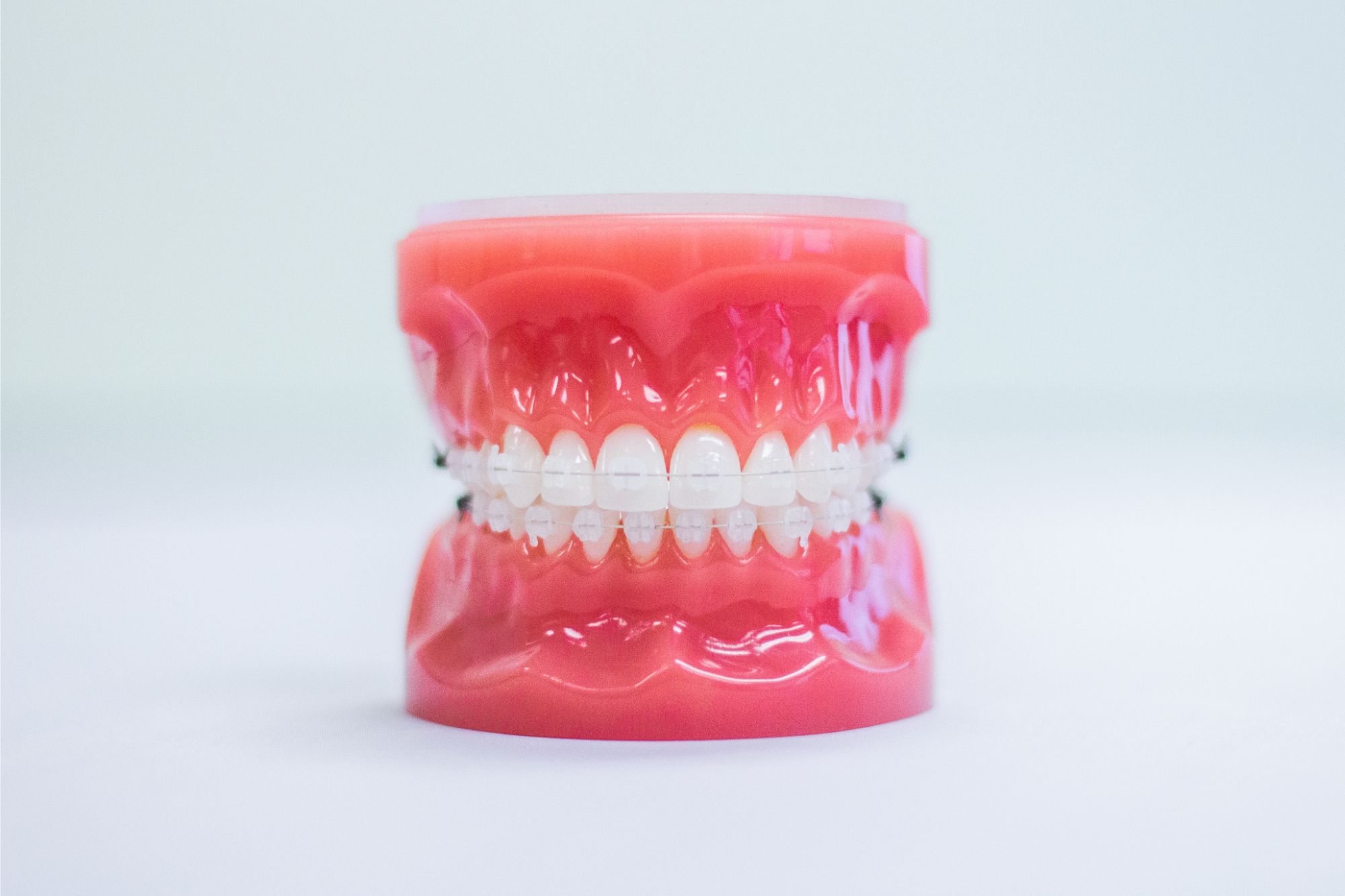 clear ceramic braces on plastic model